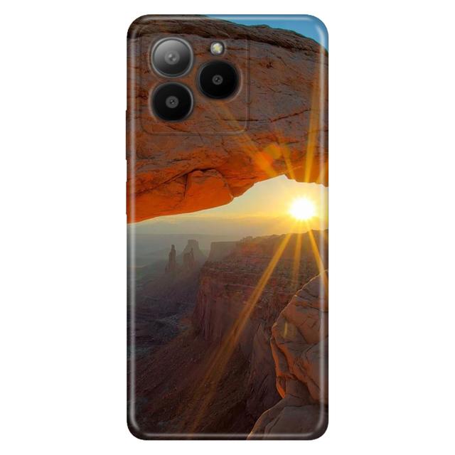 TEMU Sun Desenli Kılıf X3 X4 X5 X6 X7 Uyumlu Telefon Kılıfı