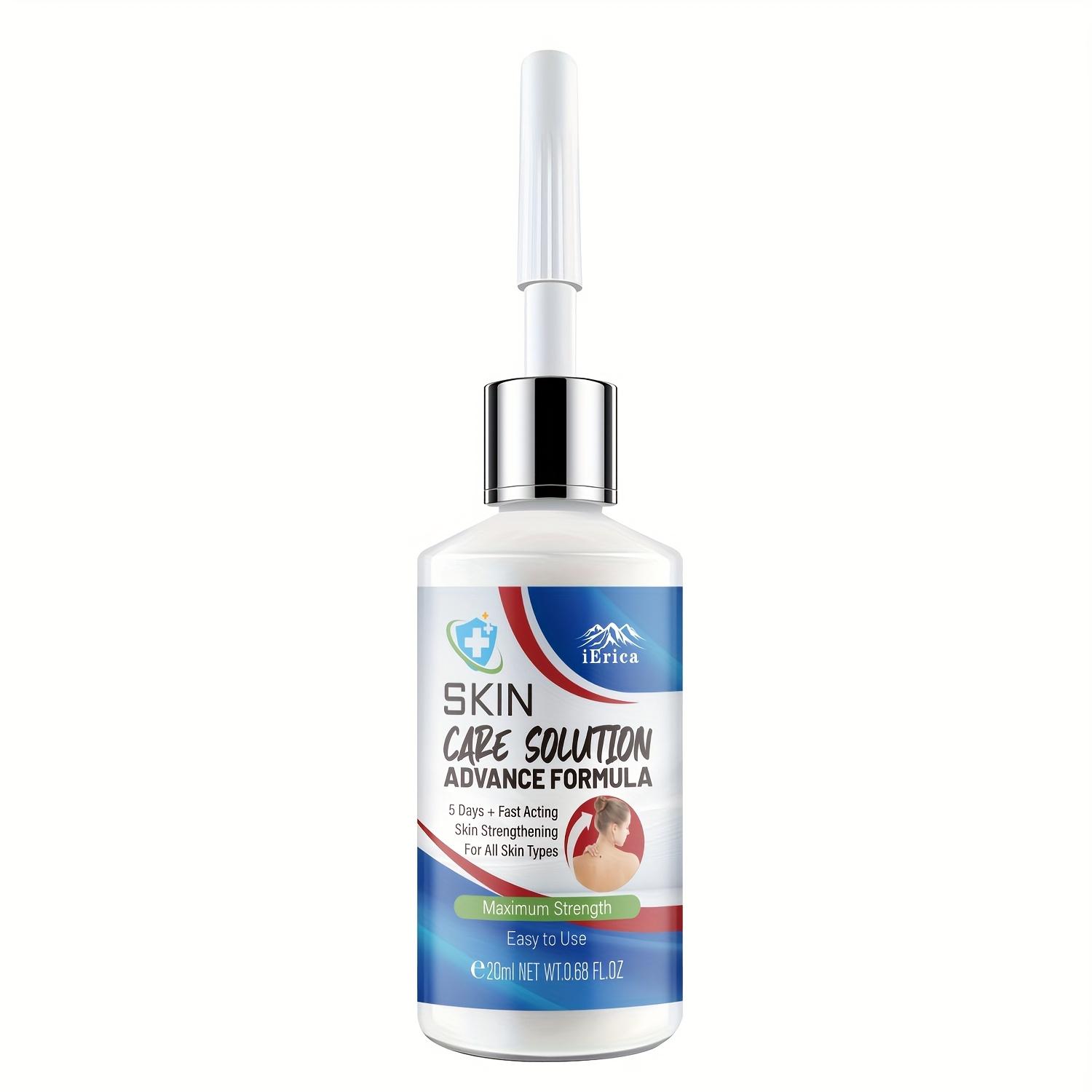 TEMU Light Beige With Salicylic Acid & Oil - Strength, Gentle For All Light Beige Types, , 20ml, Easy Application Bottle, Alcoholfree Formula