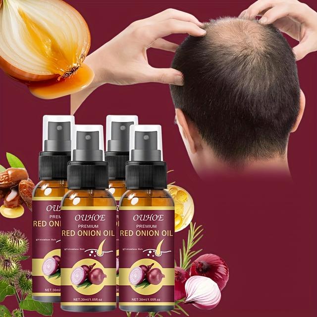 TEMU 4pcs [rosemary Hair Serum] Rosemary & Onion Hair Serum - Nourishing Scalp Massage Oil, Biotin Hair Care, Make Thin Thicker, Mother's Day Gift, Gifting - 1.01oz/pcs