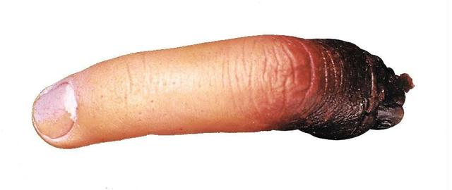 Cut Off Finger New